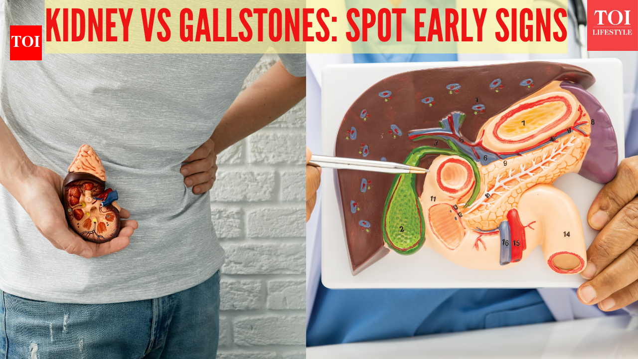 Gallstones vs Kidney Stones: Causes, differences, and key symptoms