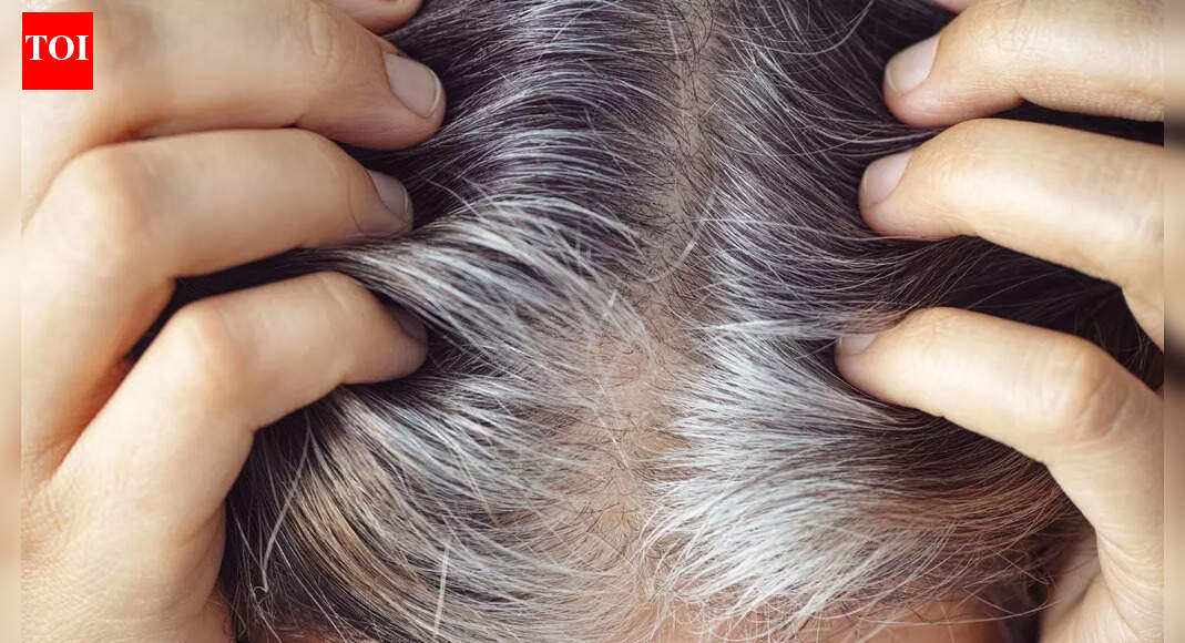 glutathione grey hair study This 'master antioxidant' could help stop your from premature graying  where to get it What Causes Gray Hair: Vitamin