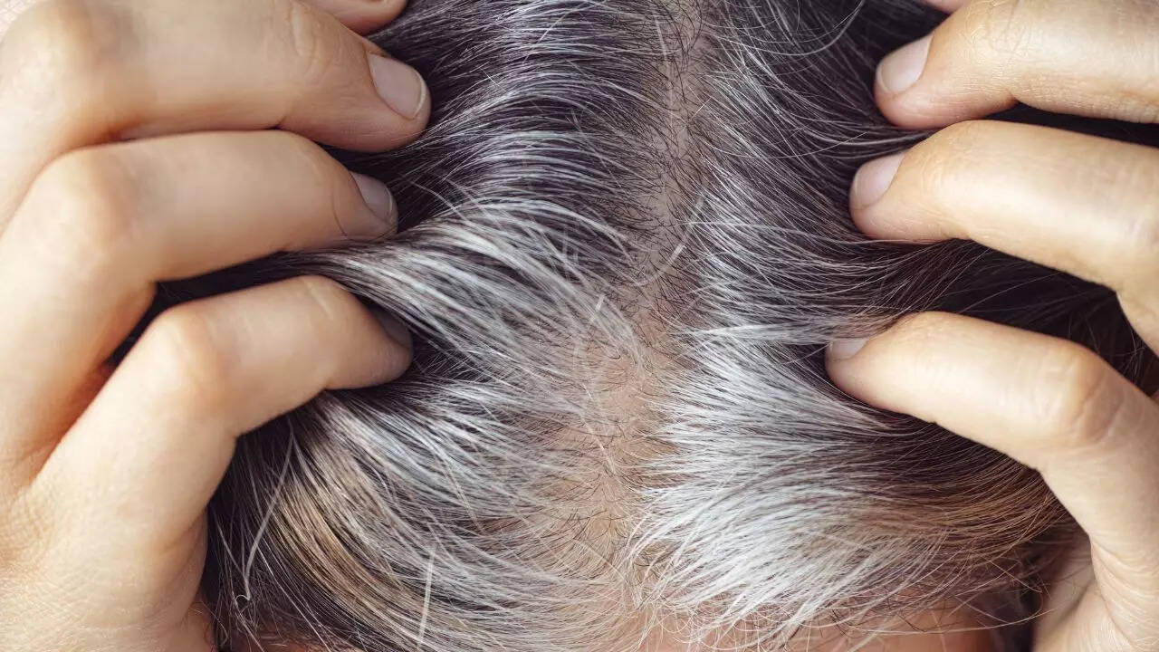 glutathione peroxidase grey hair hair: how to tackle it? like gray ZERO GRAY  Anti Grey