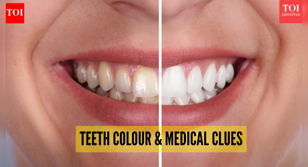 Tooth color and health: What different shades reveal about your well-being