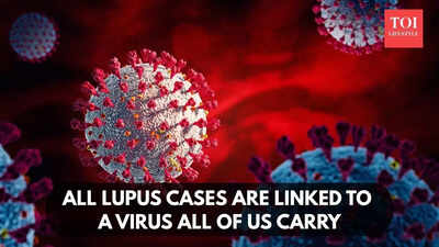 All lupus cases are linked to a virus all of us carry, study finds