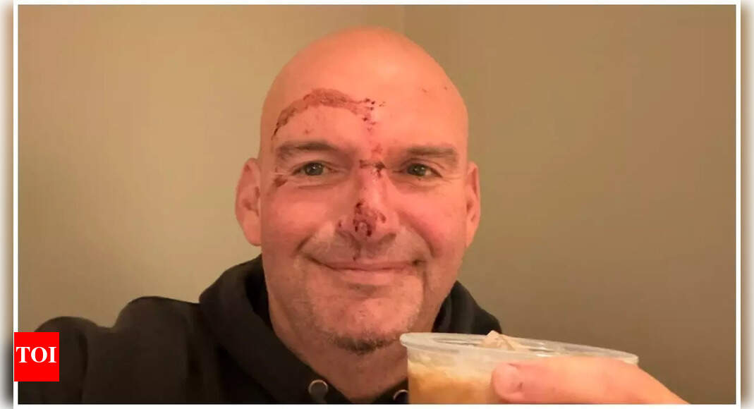 ‘Twenty stitches later ... ’: Senator Fetterman shares stitched-up selfie after fall near home