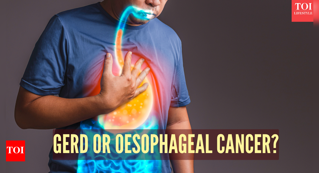 Esophageal cancer vs GERD: Symptoms, causes, and key differences | – The Times of India