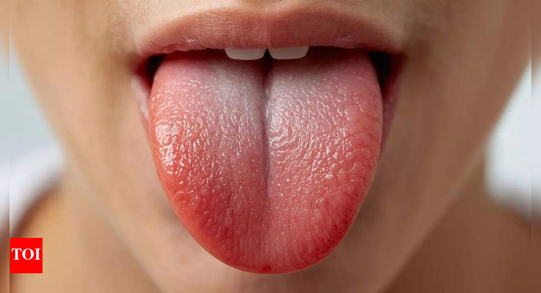 What your tongue says about your health: 10 warning signs you should never ignore