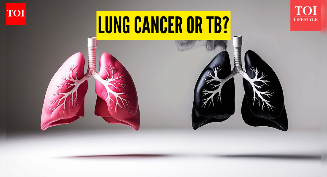 TB or Lung Cancer? Know the symptoms and differences