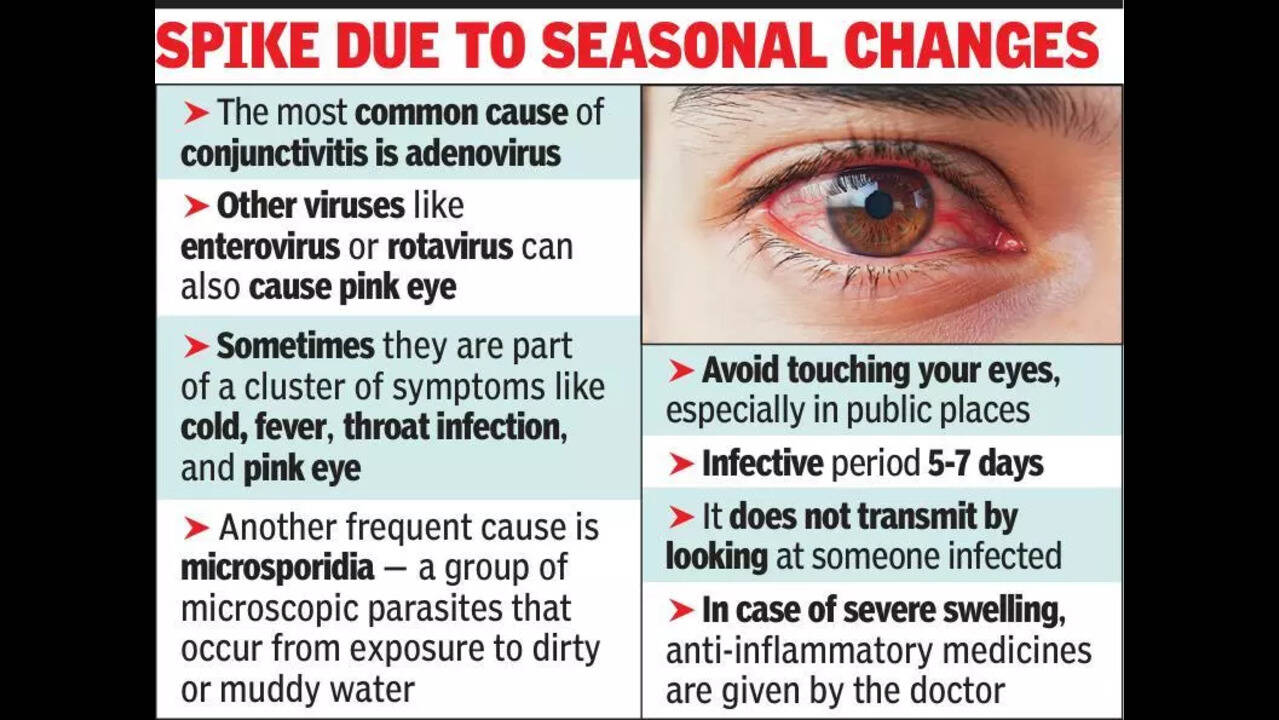 Conjunctivitis outbreak lays Kol low, rush of cases at hosp OPDs | Kolkata  News - The Times of India