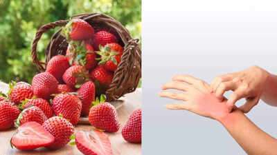 Can strawberries cause allergies: Know the signs, causes, and how to manage them