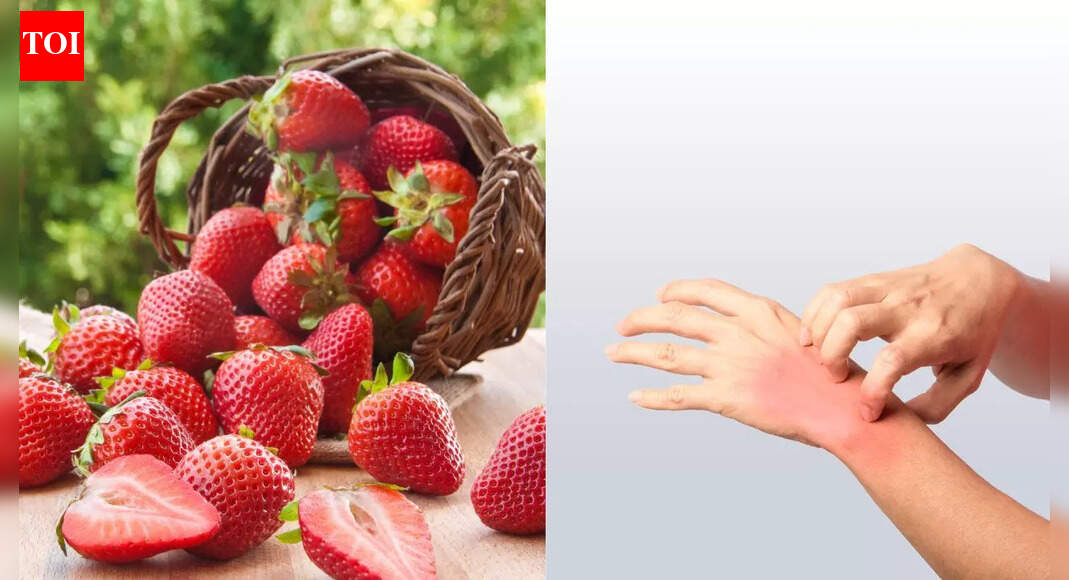 Can strawberries cause allergies: Know the signs, causes, and how to manage them