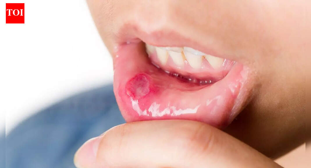 Identifying the early signs of mouth cancer: Causes, diagnosis, and why early detection matters