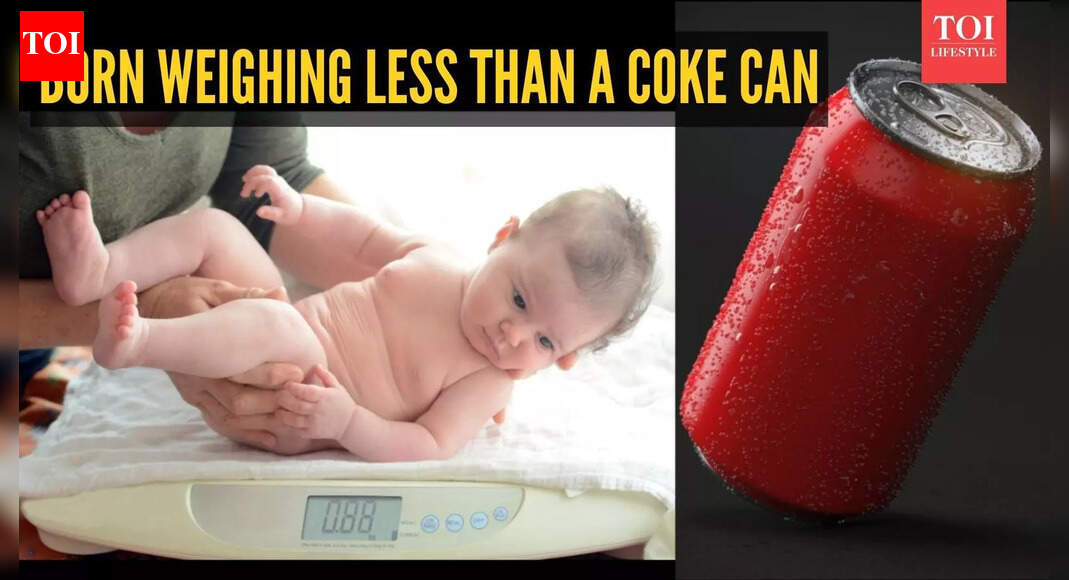 These babies are born weighing less than a coke can: What happens next will shock you