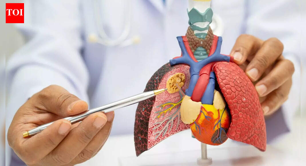 World’s first lung cancer prevention vaccine trial receives £2.06 m funding