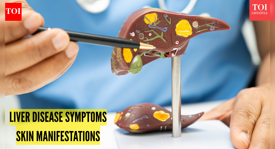4 प्रमुख लीवर क्षति चेतावनी लक्षण जो त्वचा पर दिखाई देते हैं