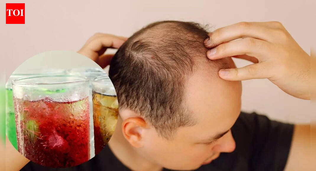 Your favourite soda could be silently causing hair loss and thinning: How sugar harms hair follicles