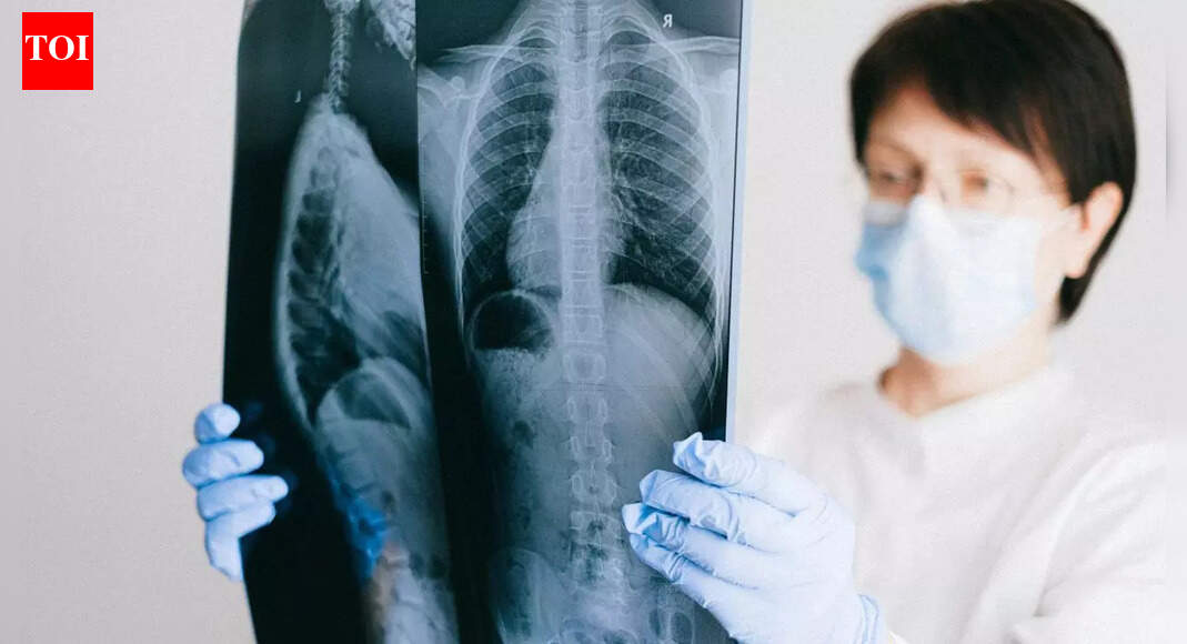 8 subtle signs of lung disease you need to recognise that go beyond cough