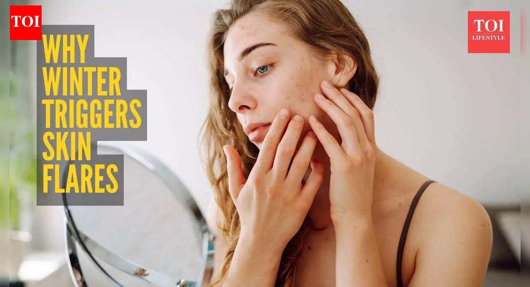 Dermatologist explains how winter damages the skin barrier and worsens eczema and psoriasis