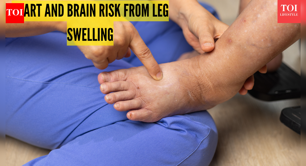 Is swelling in the legs dangerous for our heart health and brain health: Risks, causes, and remedies