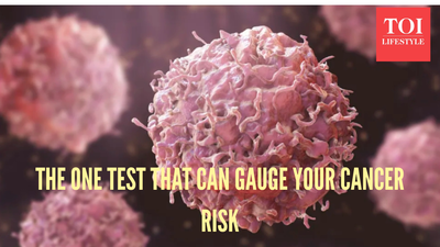 शीर्ष डॉक्टर और दीर्घायु विशेषज्ञ के अनुसार, एक परीक्षण जो आपके कैंसर के खतरे को रोक सकता है