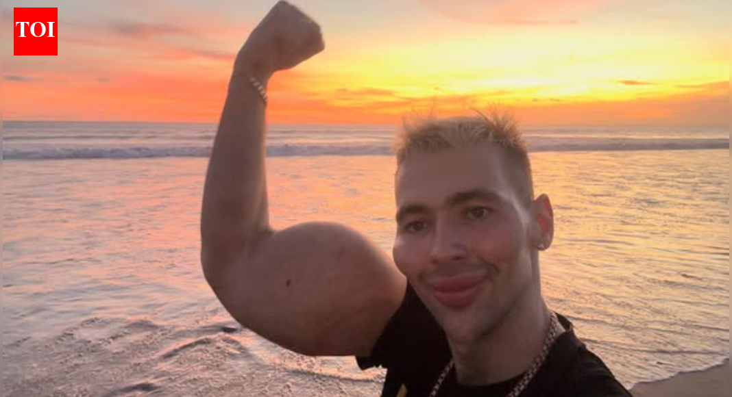 ‘Russian Popeye’: Man who injected Vaseline oil for giant biceps now faces possible arm amputation
