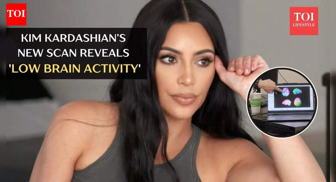 Kim Kardashian’s new scan reveals 'low brain activity' after aneurysm diagnosis: What that means