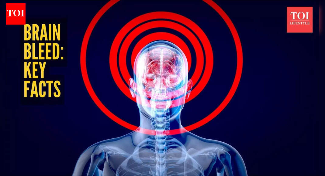 ब्रेन हैमरेज लक्षण: स्वरा भास्कर के ससुर को हुआ ब्रेन हैमरेज: चिकित्सीय स्थिति और उसके लक्षणों को समझना |