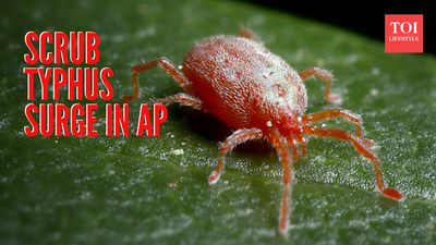 ஸ்க்ரப் டைபஸ் வழக்குகளின் அதிகரிப்பு ஆந்திரப் பிரதேச அறிக்கைகள்: அதன் அறிகுறிகளைப் புரிந்துகொள்வது மற்றும் அது இந்தியாவுக்கு எவ்வாறு வளர்ந்து வரும் அச்சுறுத்தலாக உள்ளது