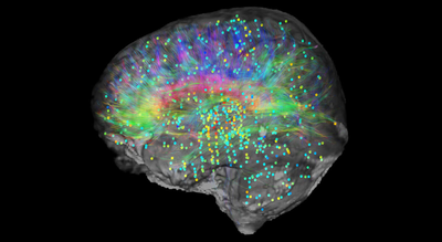 பேராசிரியரின் தீவிரக் கோட்பாடு, நனவு மூளையில் இருந்து வரவில்லை என்றும் மரணத்திற்குப் பிறகும் தொடரலாம் என்றும் கூறுகிறது.