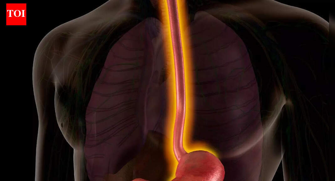 How everyday foods increase risks of esophageal cancer: What to avoid and what to eat instead