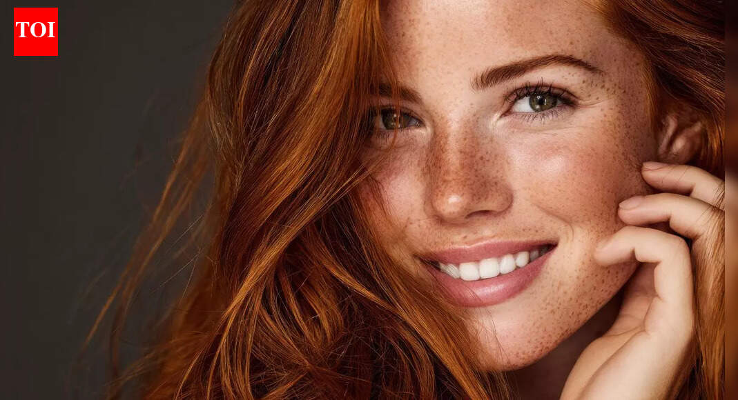 If you have red hair, this shocking new study says your wounds may heal differently