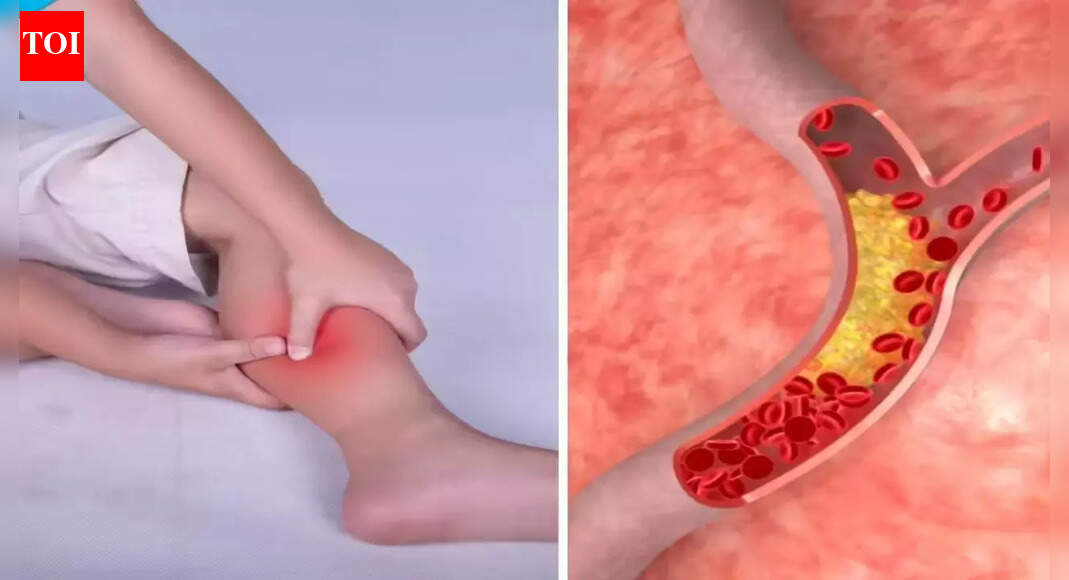 High cholesterol symptoms in legs at night: Warning signs you should never ignore