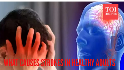 Top neurologist reveals the hidden reasons behind a stroke, even in 'healthy adults'; 'Strokes often have non-traditional or hidden causes...'