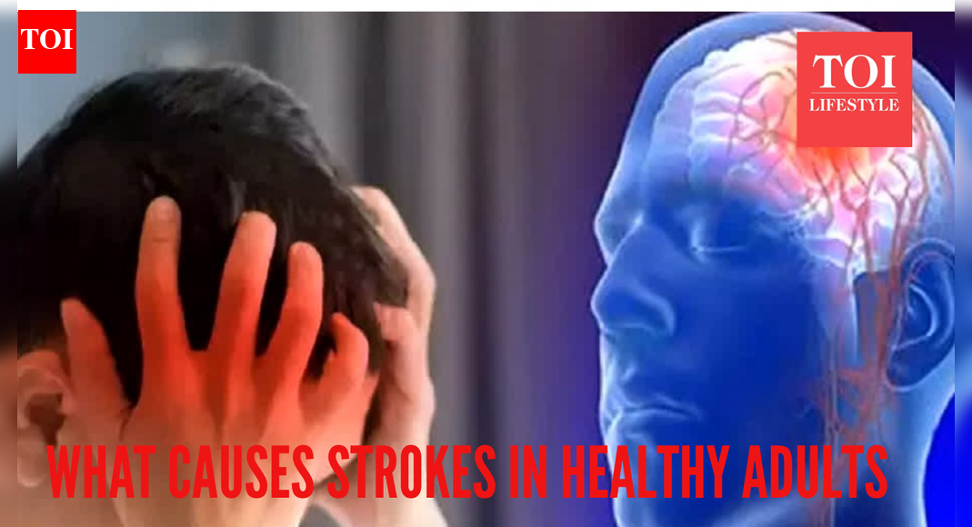 Top neurologist reveals the hidden reasons behind a stroke