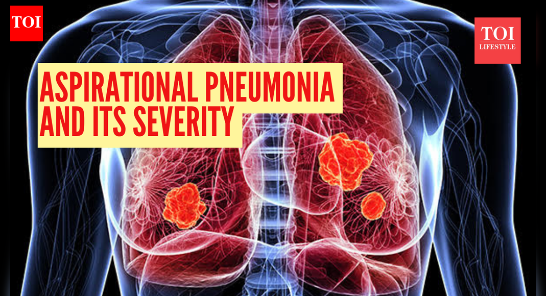 Aspiration pneumonia: Doctor explains how a 'simple accident' can lead to this life-threatening condition