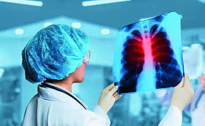 People living near mines showing lung damage