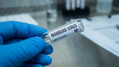 Saudi citizens warned as deadly Marburg Virus outbreak hits Southern Ethiopia