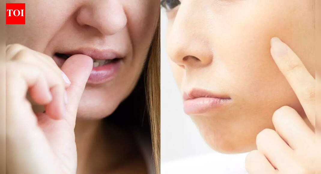 आप अपनी त्वचा का चयन बंद क्यों नहीं कर सकते: जानिए वास्तव में इसका कारण क्या है और आप इस चक्र को कैसे तोड़ सकते हैं |