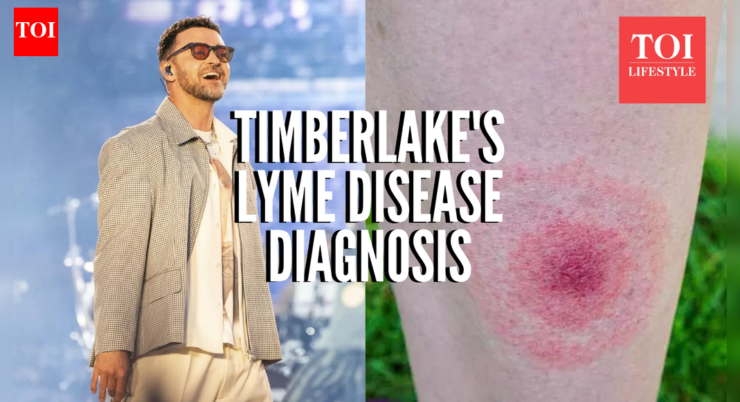 Justin Timberlake's lyme disease diagnosis: What to know about the tick-borne illness
