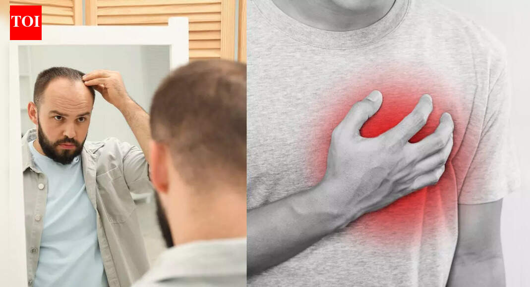 पुरुषों में गंभीर बालों का झड़ना प्रारंभिक हृदय समस्याओं का संकेत हो सकता है: नए शोध से क्या पता चलता है |