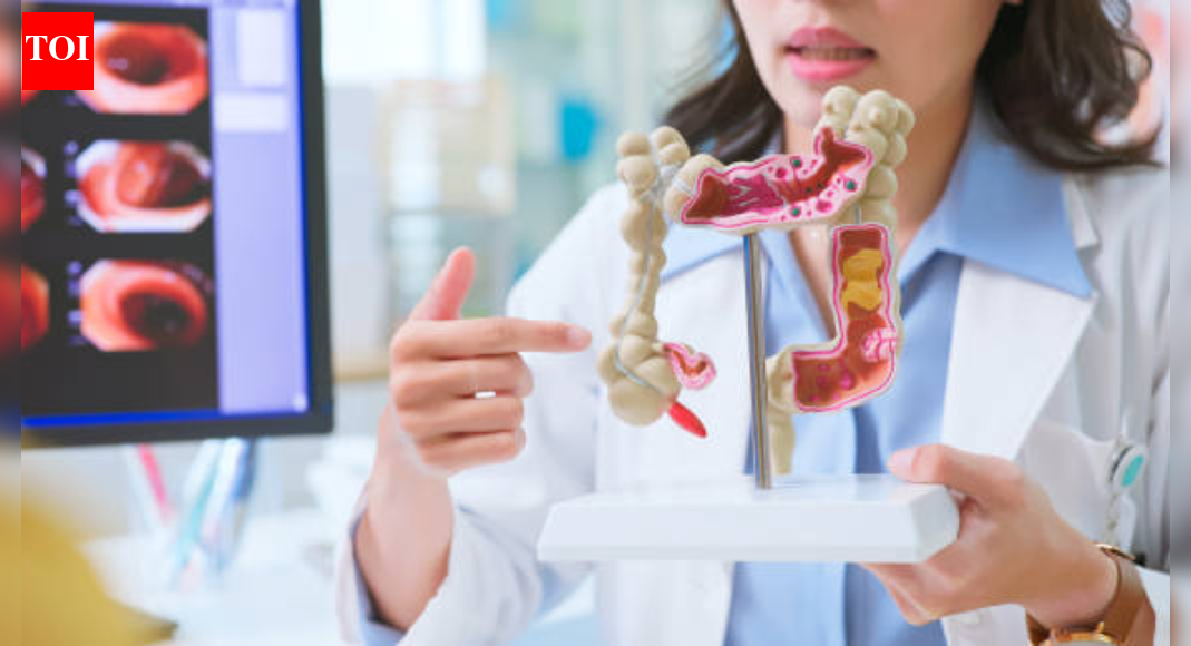 Colon cancer myths that mislead patients, pretend to be harmless, and delay diagnosis