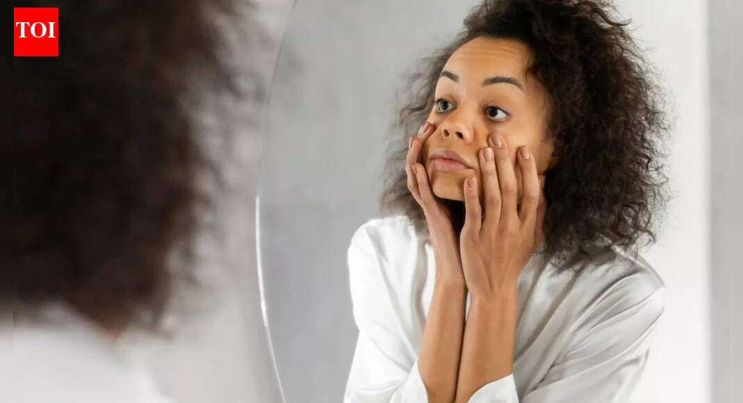 Do your dark circles worsen in winter? The real reasons your eyes look tired