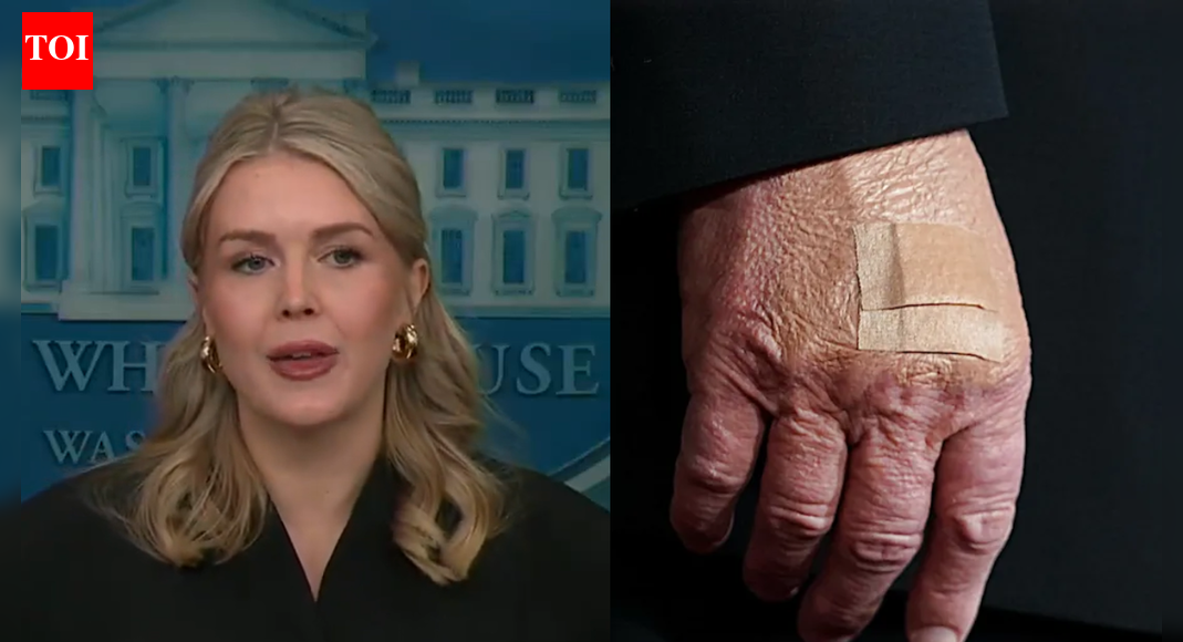Karoline Leavitt reveals why there are bandages on Trump's hand: 'The president is literally...'