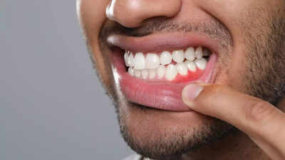 Gum diseases may affect more than teeth: How poor oral health raises stroke risk; key tips to protect oral and brain health