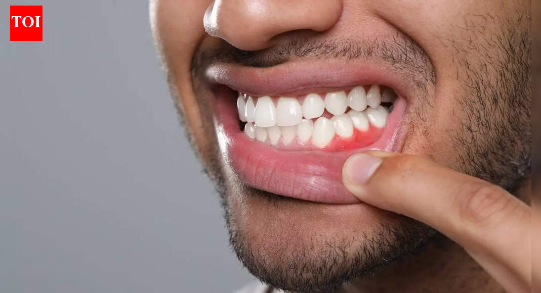 Gum diseases may affect more than teeth: How poor oral health raises stroke risk; key tips to protect oral and brain health