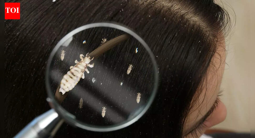 Why lice exist and where they actually came from