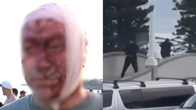 एक व्यक्ति जो 7 अक्टूबर को हमास के हमले में बच गया था और बॉन्डी बीच पर हुई गोलीबारी में घायल हो गया था, उसका कहना है 