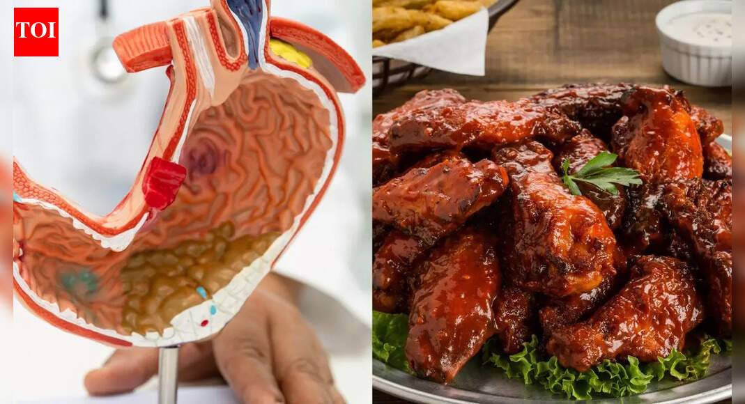 Can eating chicken daily increase gastric cancer risk? Experts explain
