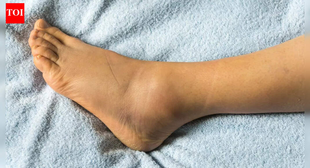 Serious​‍​‌‍​‍‌​‍​‌‍​‍‌ health risks of ignoring ankle swelling: Common underlying causes and treatment