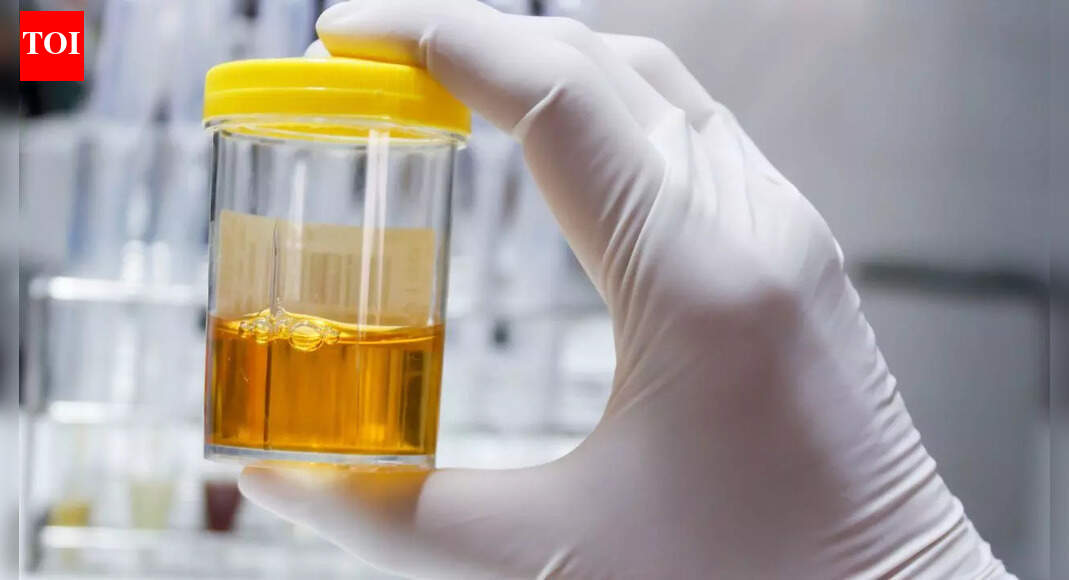 Foods and drinks that can make urine cloudy: Diseases and health conditions linked to it