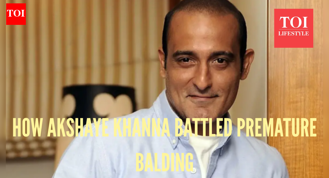 How Dhurandhar star Akshaye Khanna started losing hair at 19; what triggers premature balding, and why it is not always genetic