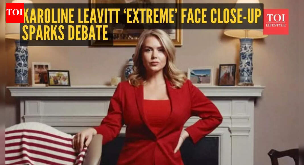 ‘Are those lip filler marks?’ Vanity Fair extreme close-up of Karoline Leavitt sparks online speculation