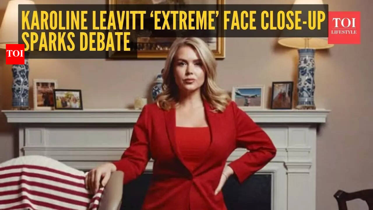 Are those lip filler marks?' Vanity Fair extreme close-up of Karoline  Leavitt sparks online speculation | - The Times of India